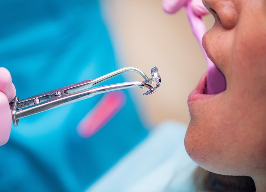 WBD Endodontics