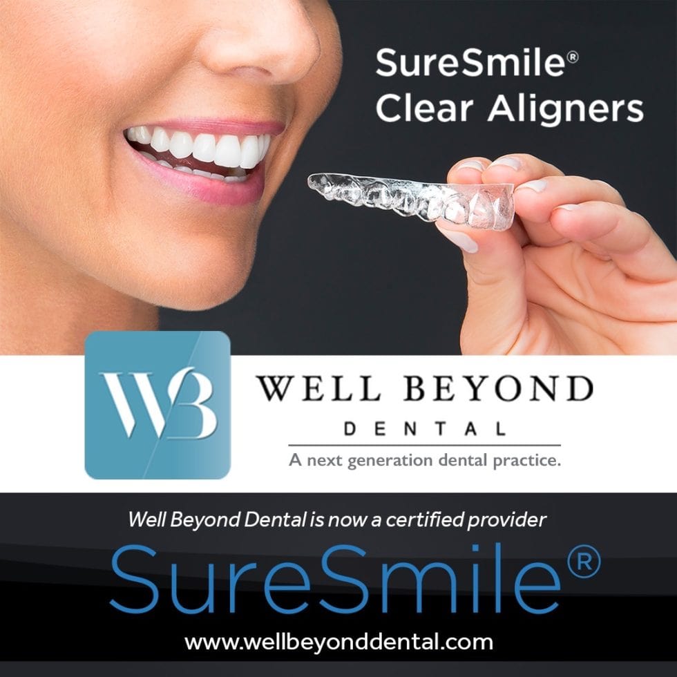 SureSmile Clear Aligners